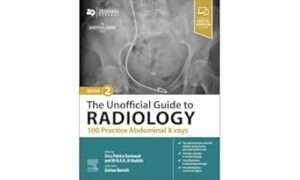 The Unofficial Guide to Radiology: 100 Practice Abdominal X-rays, 2e By Zeshan Qureshi