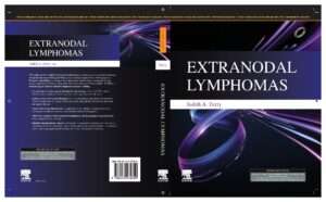 Extranodal Lymphomas,1e : Judith A. Ferry