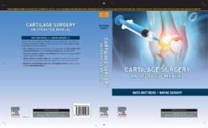 Cartilage Surgery,1e : Mats Brittberg & Wayne Gersoff