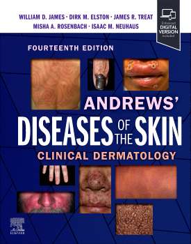 Andrews' Diseases of the Skin,International Edition: Clinical Dermatology,14e : James